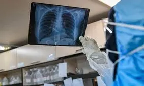 خطر اوج مجدد کرونا در کشور/ افراد بی‌علامت هم ماسک بزنند