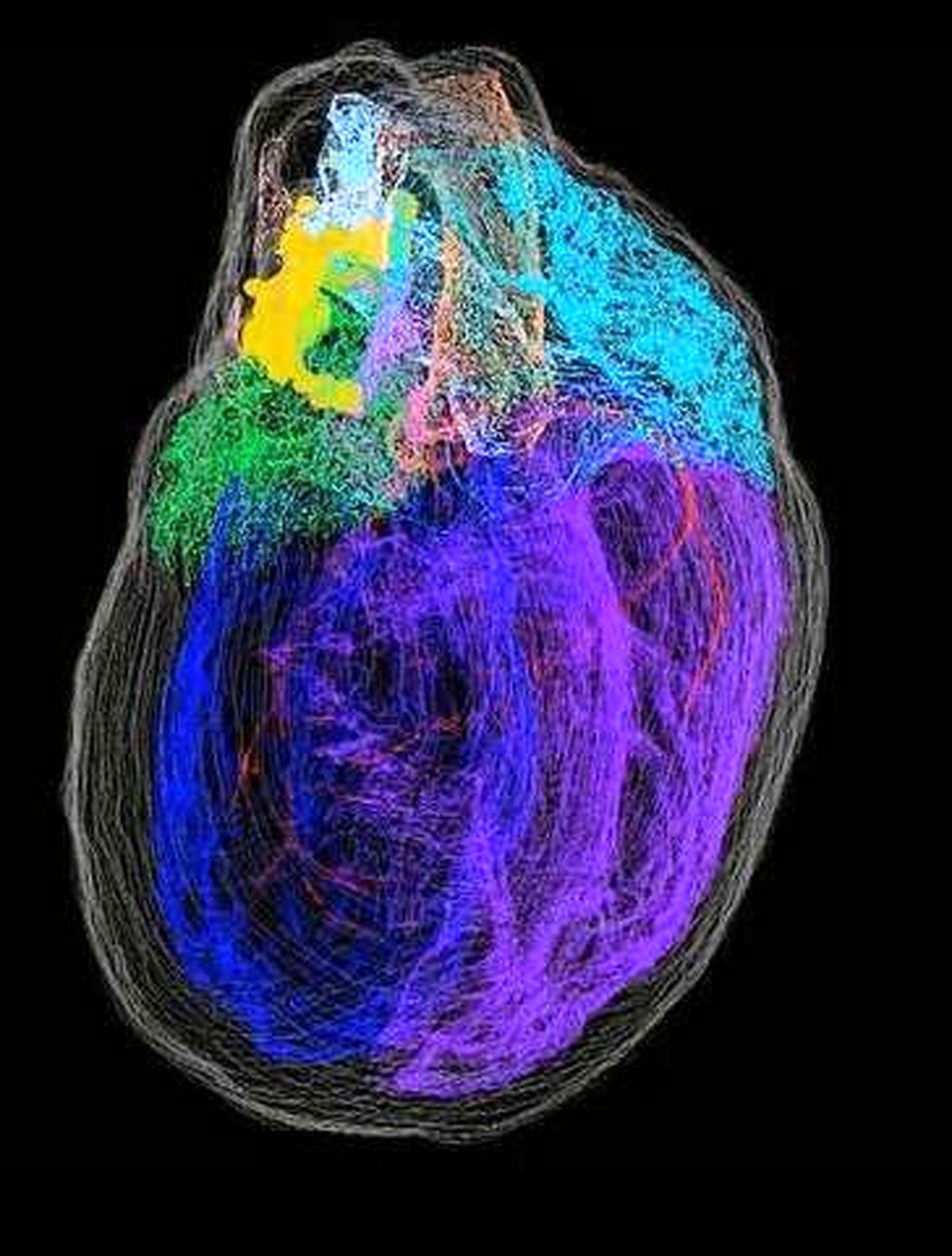 نخستین نقشه ۳بعدی از نورون‌های قلب ارائه شد