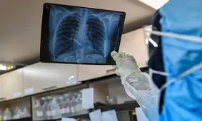 موج اول شیوع کرونا پایان نگرفته است