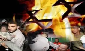 روایتی از سابقه کودک‌کشی صهیونیست‌ها به بهانه کارهای آزمایشگاهی