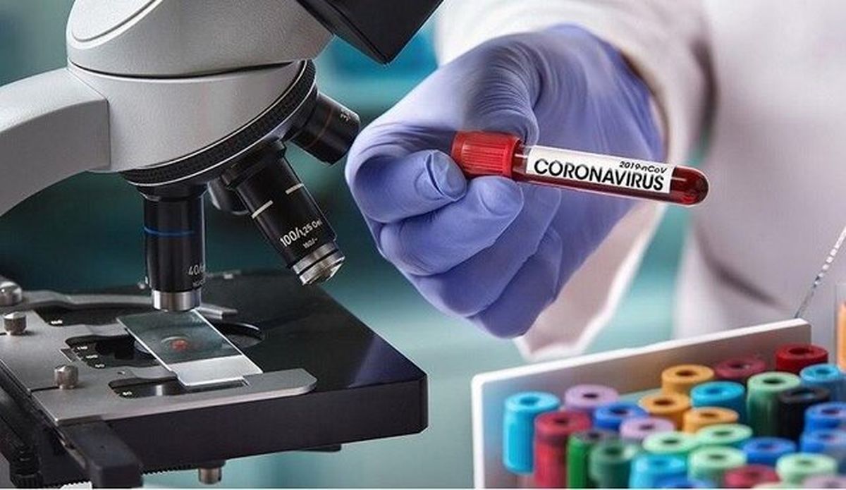 تولید کیتهایی که در ۱۰ دقیقه کرونا را تشخیص میدهند