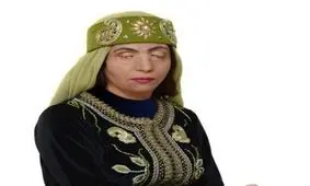 زنان قربانی اسید پاشی برای اولین بار در ایران مدل لباس شدند/عکس