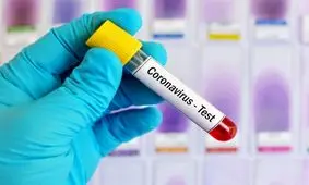 افزایش روند مبتلا به کرونا در همدان