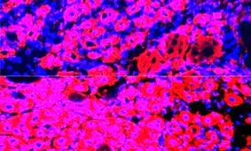 معکوس کردن روند پیری با رقیق کردن پلاسمای خون