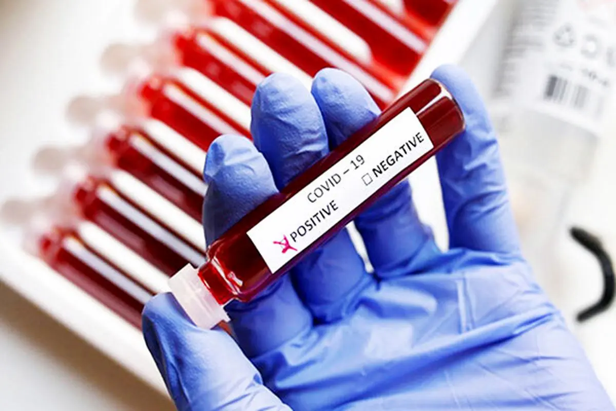 شناسایی دو مورد قطعی و یک مورد مشکوک به کرونا در تیم ماشین‌سازی