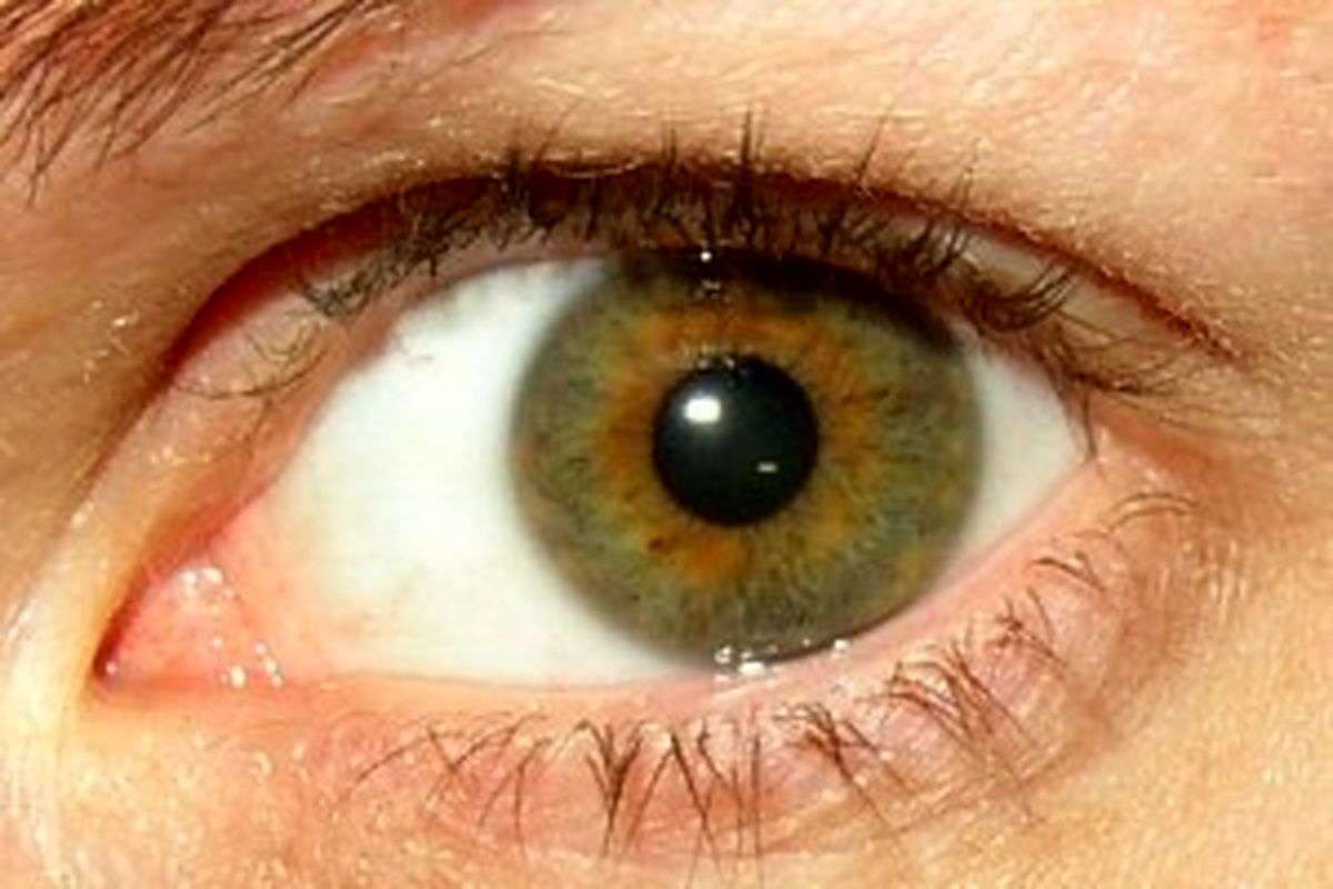 چگونه از آلودگی چشمها به ویروس كرونا جلوگیری كنیم؟