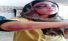 دستگیری پیرمرد ۸۳ ساله‌ای که زن جوانش را شکنجه کرد + عکس