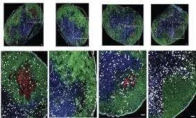 کنترل بیماری‌های خودایمنی با کمک یک پروتئین