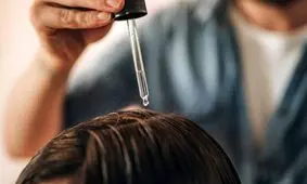 شوره سر چیست و چگونه درمان می شود؟