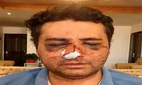 ضرب و شتم شدید یک متخصص بیهوشی توسط همراهان یک بیمار در پیرانشهر/ عکس