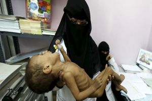۶۶ درصد یمنی‌ها هیچ غذایی ندارند