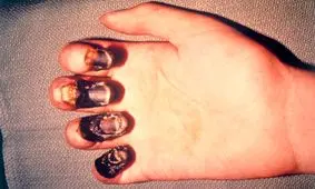 کابوس جدیدی به نام طاعون خیارکی!