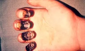 "طاعون خیارکی" اتفاق جدیدی نیست/ شایعات را جدی نگیرید