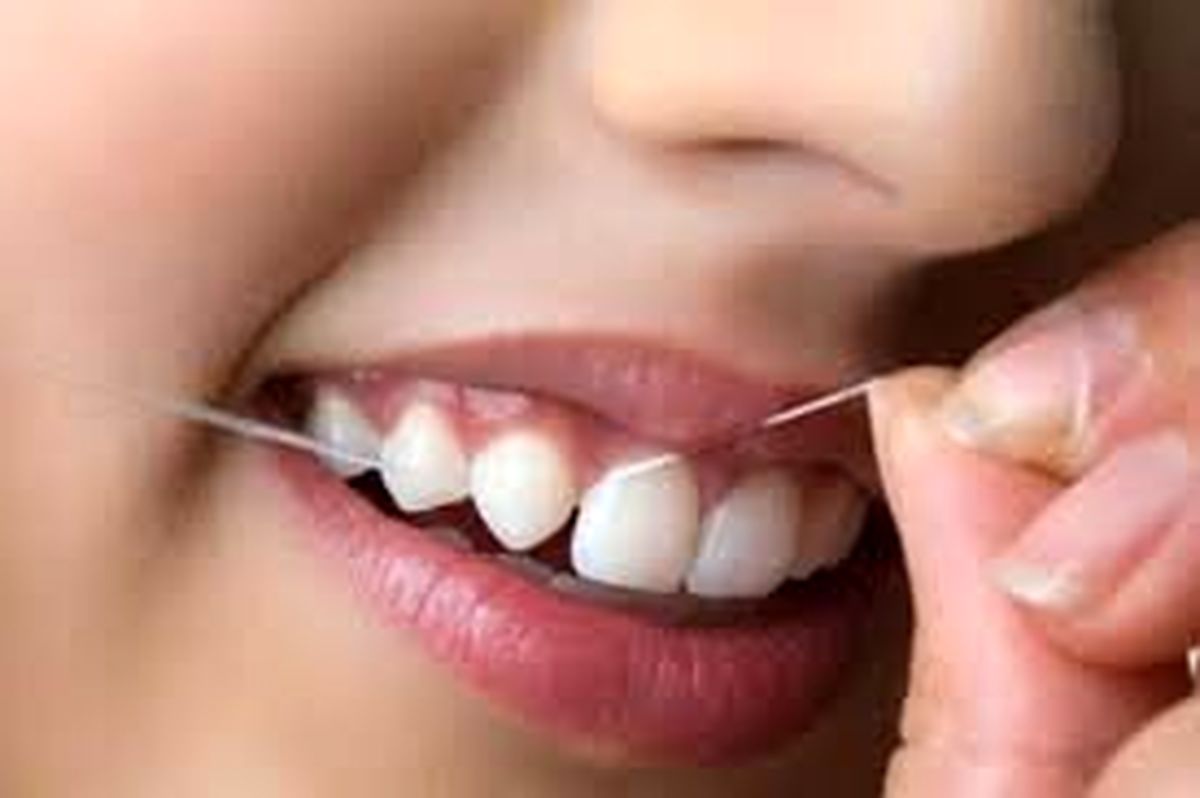 ۵ روش طبیعی برای تقویت لثه