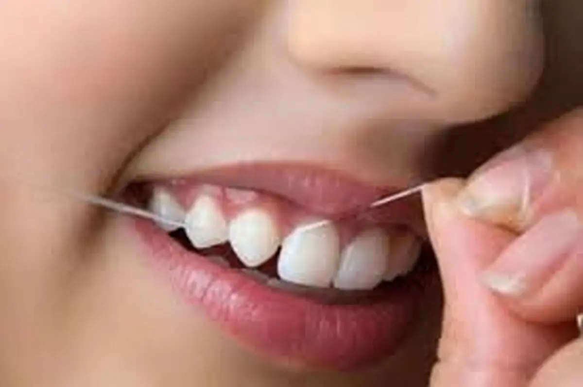 ۵ روش طبیعی برای تقویت لثه‌