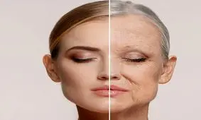 چرا صورتم چین و چروک دارد؟