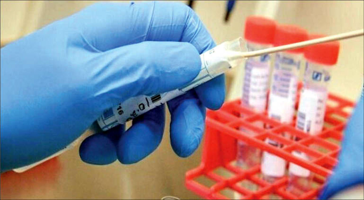 تست های بی اعتبار کرونا در منازل