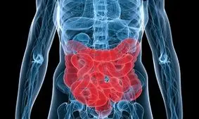 این عادات ناسالم منجر به سرطان روده می‌شود