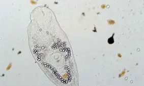 انگل‌ها موجودات مهمی هستند که باید حفظ شوند!