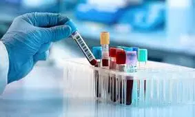 کرونا در بردسکن/ ابتلاء کودک ۱۰ روزه تا زن ۸۸ ساله