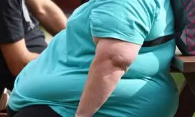 چاقی و ۴ توصیه پزشکی برای مقابله با آن