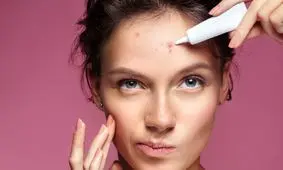 برای کاهش جوش‌های صورت چه خوراکی‌هایی بخورم؟