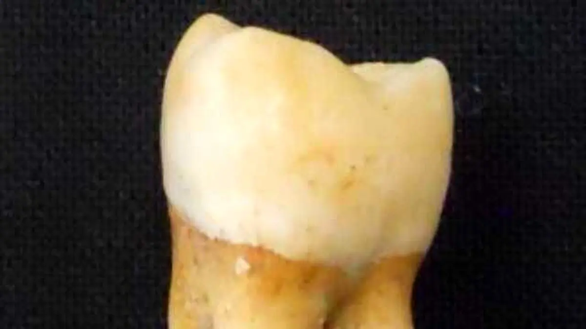 آیا مینای دندان جنسیت بقایای چندهزار ساله انسان را تعیین می‌کند؟