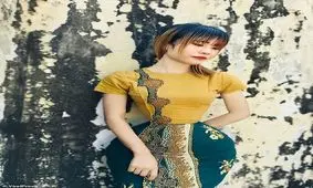 زنی که دور کمرش فقط ۳۴ سانتی متر است/ عکس