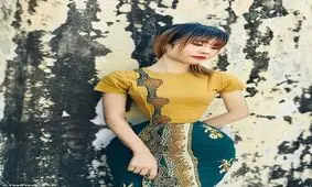 زنی که دور کمرش فقط ۳۴ سانتی متر است/ عکس