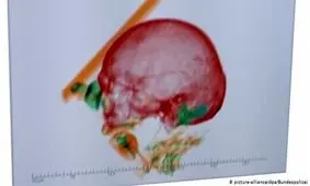 ماجرای کشف یک جسد در چمدانی در فرودگاه مونیخ