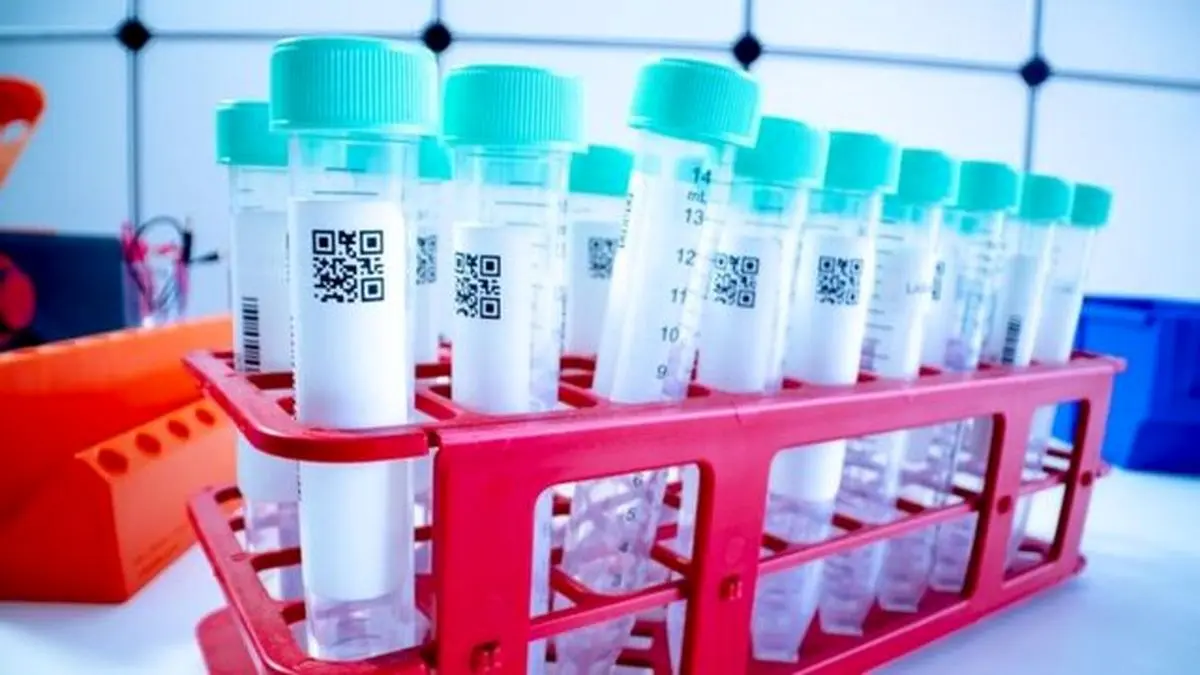 معیار اعلام آمار فوتی‌‌های کرونا تست مثبت PCR است