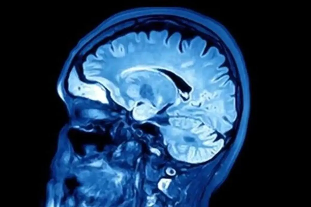 آیا افرادی که هنگام بلندشدن سرگیجه دارند در معرض زوال عقل هستند؟