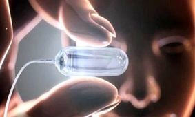 فیلم / عملکرد کپسولهای بادکنکی خوردنی در معده