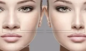 عمل زیبایی با نصف قیمت!