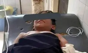 "گاندو" دست کودک چابهاری را قطع کرد