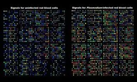 یک کشف تازه درباره مالاریا و روزنه امید برای درمان ضدویروسی"کووید-۱۹"