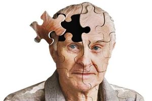 حقایقی مهم درباره آلزایمر