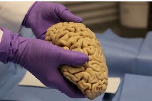  نگهداری ۱۰ هزار مغز انسان در دانمارک/ خانواده متوفیان برای نگهداری مغزها مجوز نداده‌اند/ ویدئو
