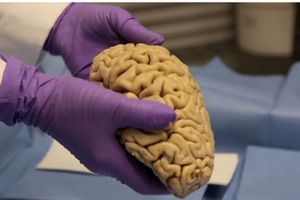  نگهداری ۱۰ هزار مغز انسان در دانمارک/ خانواده متوفیان برای نگهداری مغزها مجوز نداده‌اند/ ویدئو