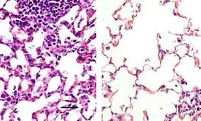 موفقیت واکسن بینی "کووید-۱۹" در موش‌ها