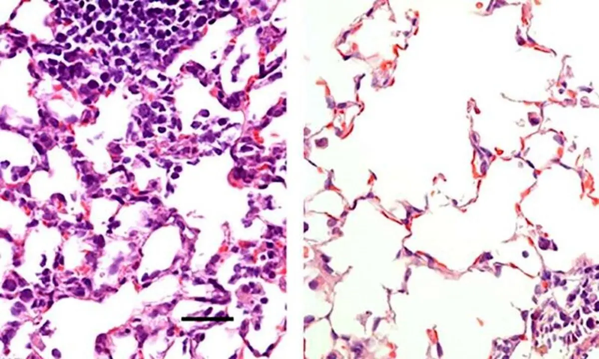 موفقیت واکسن بینی "کووید-۱۹" در موش‌ها