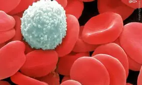 کدام سرطان‌ها در ایران شایع‌ترند؟