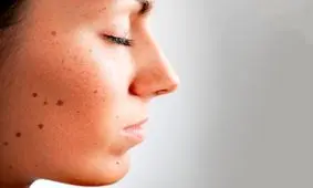 انـواع خـال را بشناسید