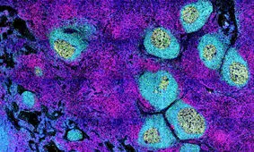 دلیل ابتلای مجدد افراد به کرونا کشف شد