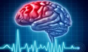 آنچه که در مورد سکته مغزی باید بدانیم