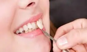 راز پلید آقای دندانپزشک در ویزیت بابلی ها