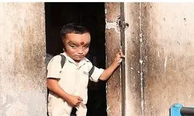 رفتار مردم هند با پسر بچه عجیب الخلقه خبر ساز شد / عکس