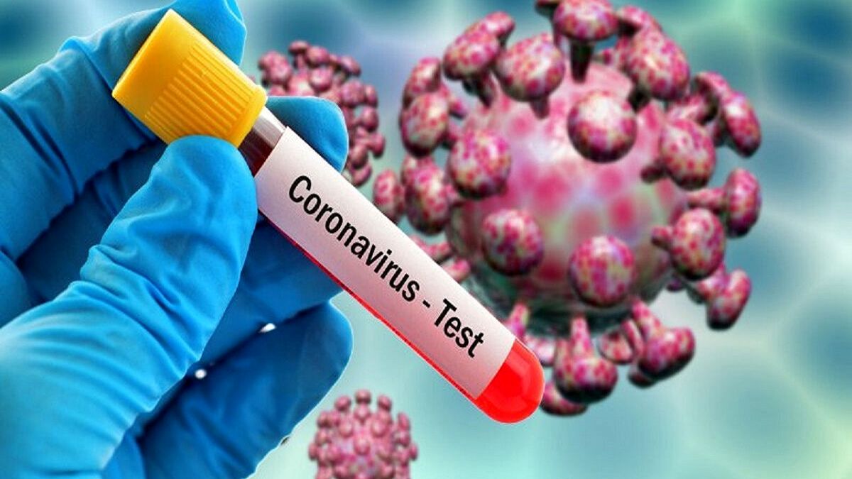 آمار جدید بیماران کرونایی در استان چهارمحال وبختیاری اعلام شد