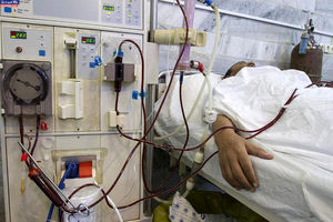 درد و رنج مضاعف بیماران دیالیزی قزوین زیر دستگاه‌های غیر استاندارد
