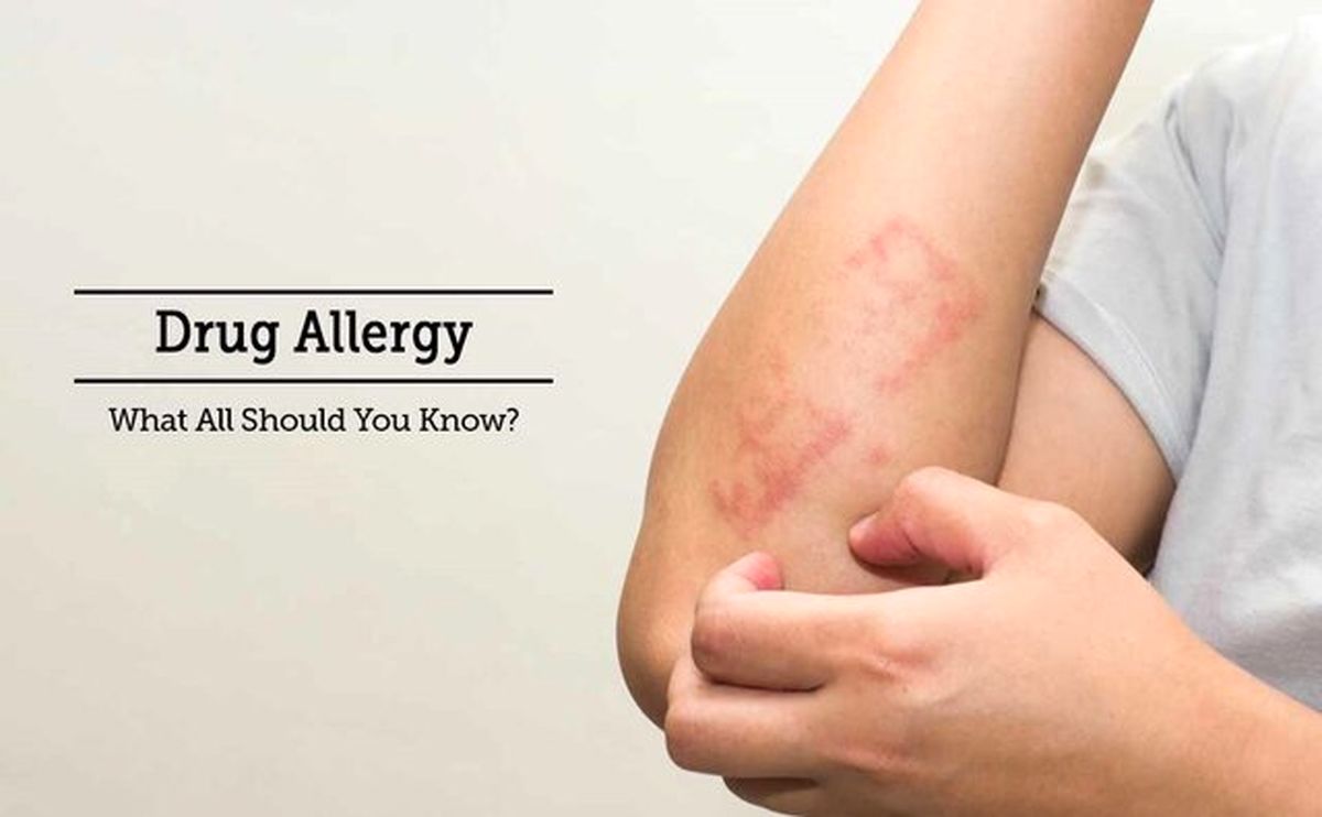 علائمِ شایعِ آلرژی دارویی چیست؟